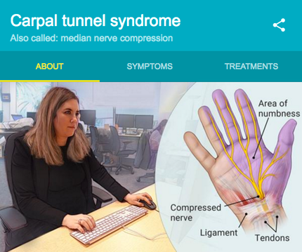 Carpal Tunnel Syndrome diagram