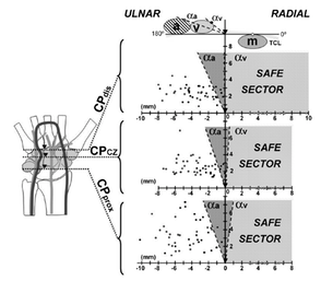 ultrasound-guided-carpal_med